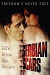 Serbian Scars